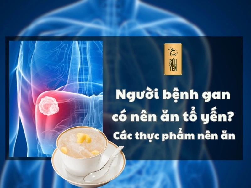 Người Bệnh Gan Có Nên Ăn Tổ Yến? - Tìm Hiểu Lợi Ích và Lưu Ý