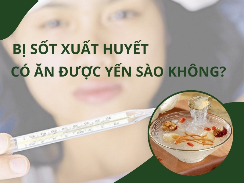 sot-xuat-huyet-an-yen-sao-duoc-khong-giai-dap