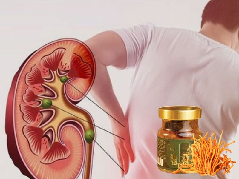yến sào đông trùng hạ thảo tăng cường khả năng phục hồi của thận